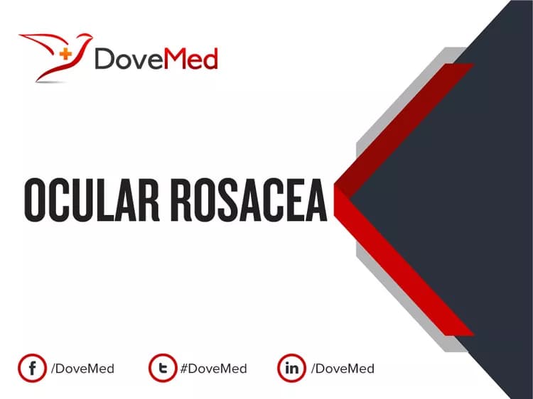 Ocular Rosacea