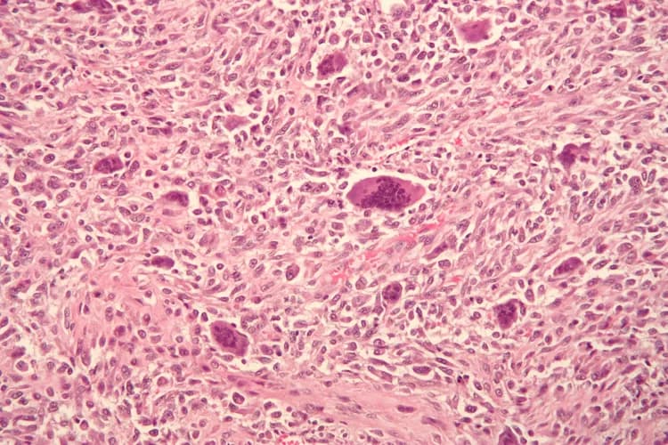 Nephron