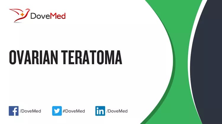 Ovarian Teratoma