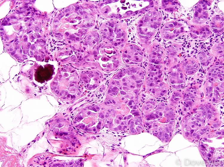 New Pathway To Differentiation Found, Shedding Light On Some Cancers