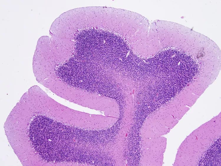 Brain Receptor Regulates Fat Burning In Cells