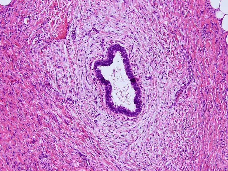 Radiologists Detect Breast Cancer In 'Blink Of An Eye'