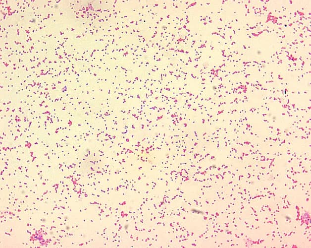 CDC/Courtesy of Larry Stauffer