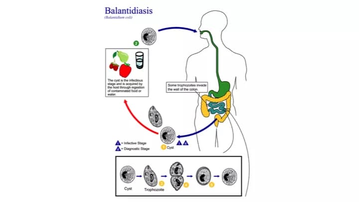 CDC/Alexander J. da Silva, PhD/Melanie Moser
