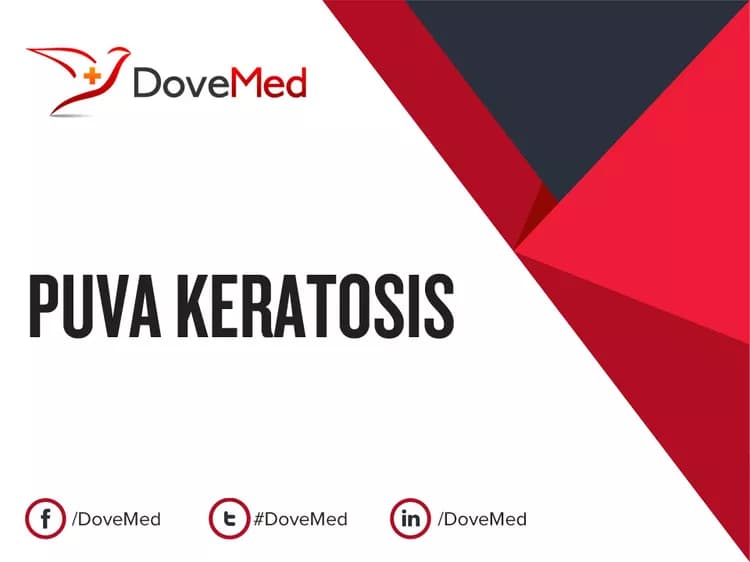 PUVA Keratosis