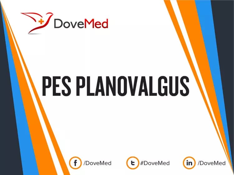 Pes Planovalgus
