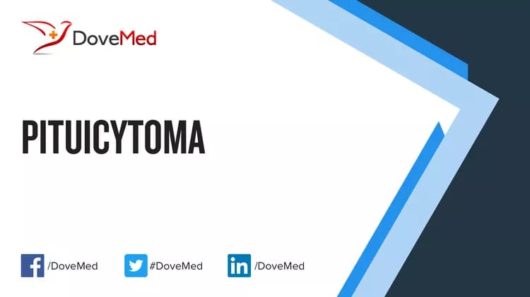 Pituicytoma