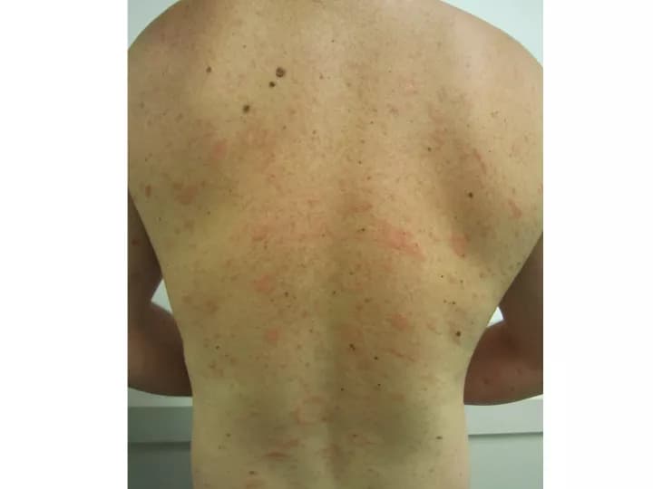 James Heilman,MD