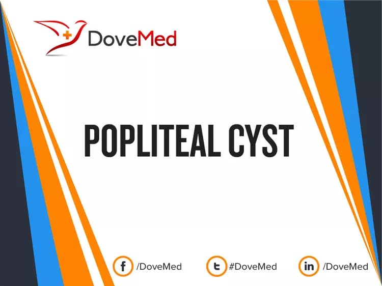 Popliteal Cyst