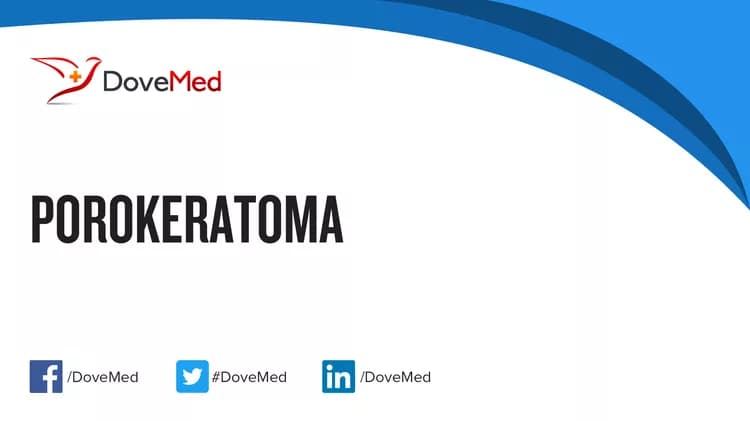 Porokeratoma