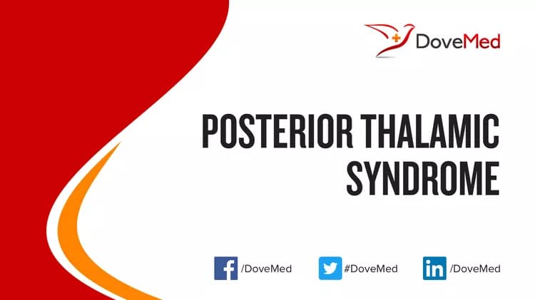 Posterior Thalamic Syndrome