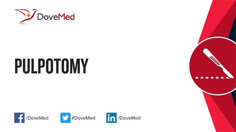 Pulpotomy