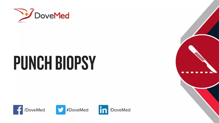 Punch Biopsy