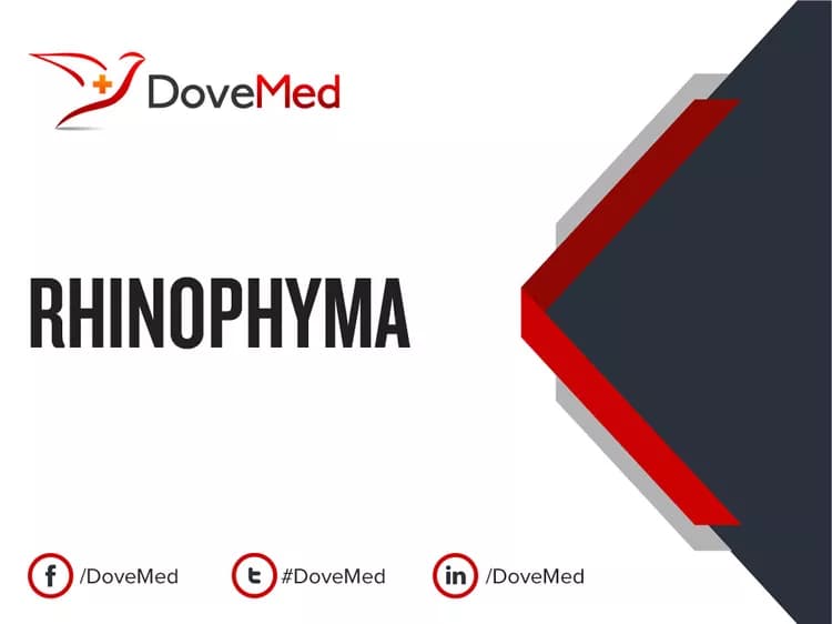 Rhinophyma
