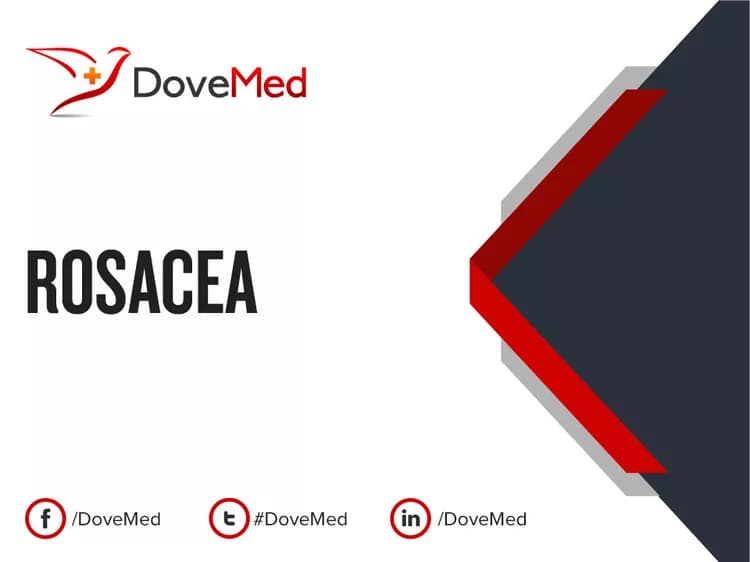 Is the cost to manage Rosacea in your community affordable?