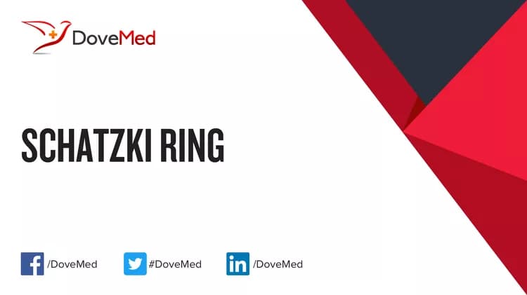 Schatzki Ring