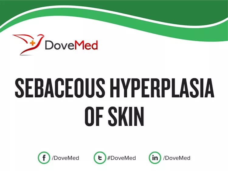 Sebaceous Hyperplasia of Skin