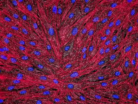 Tom Deerinck and Mark Ellisman, National Center for Microscopy and Imaging Research