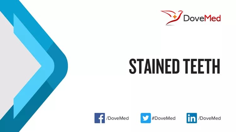 Are you satisfied with the quality of care to manage Stained Teeth in your community?