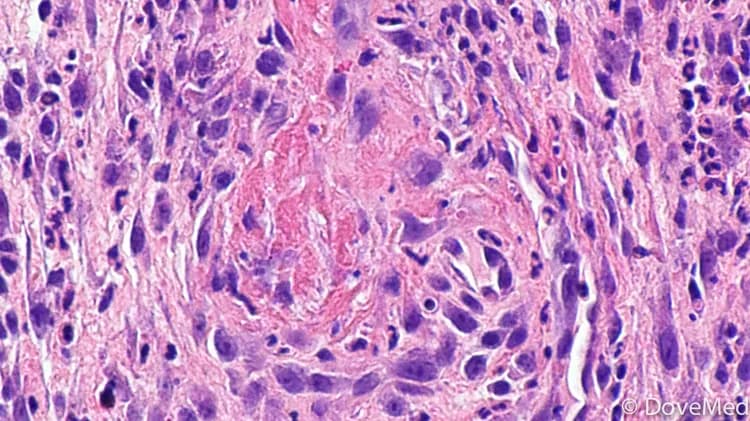 Image by Nephron - Wikicommons