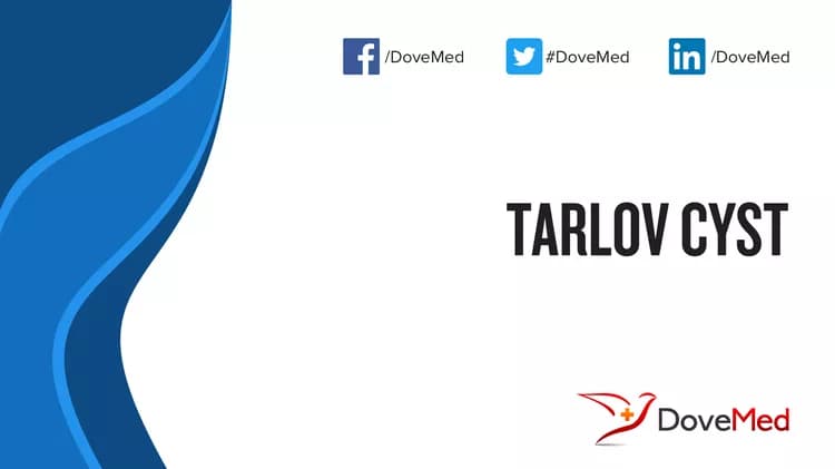 Tarlov Cyst