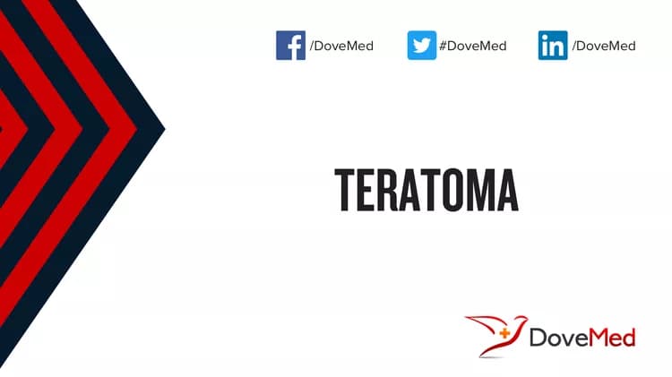 Teratoma