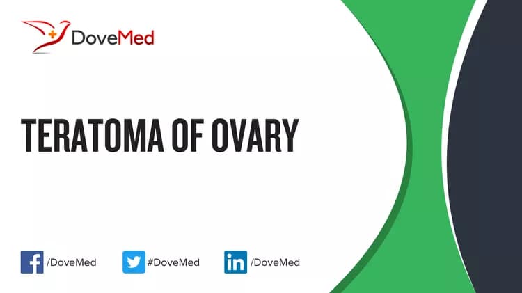 Teratoma of Ovary