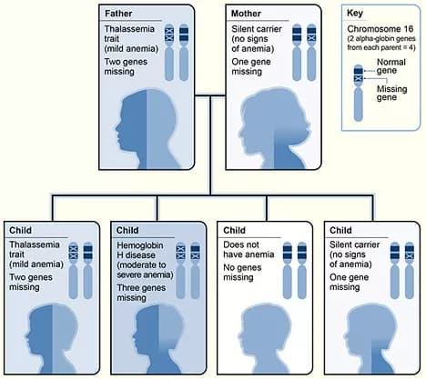 Alpha Thalassemia