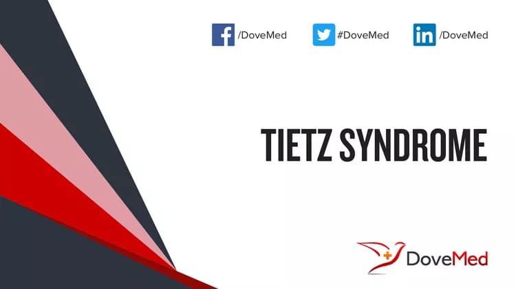 Tietz Syndrome