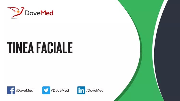 Tinea Faciale