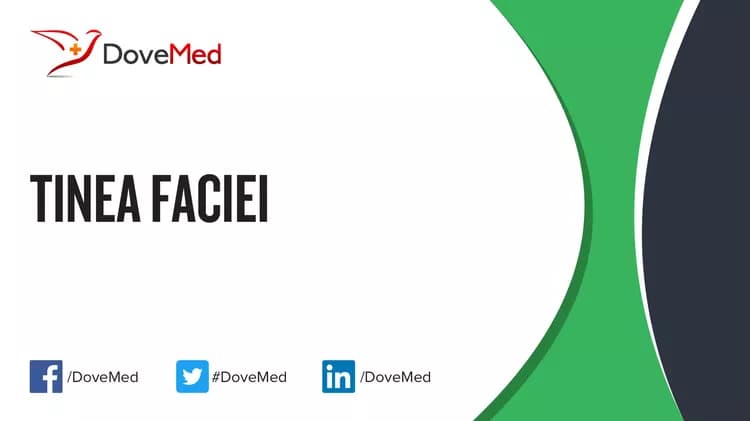 Tinea Faciei