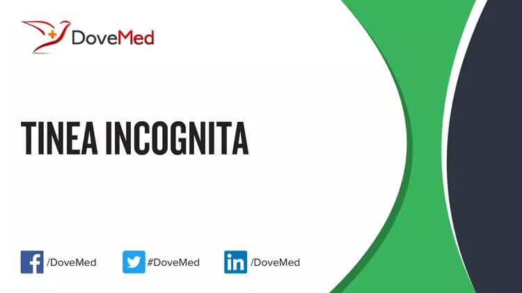 Tinea Incognita