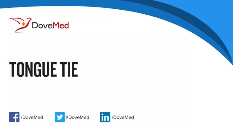 Is the cost to manage Tongue Tie in your community affordable?