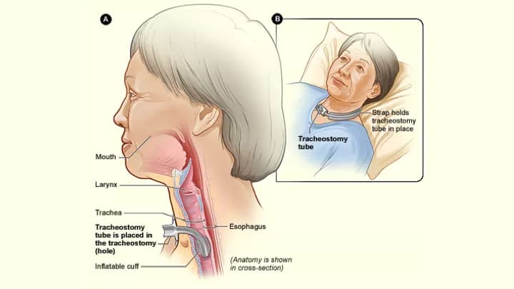 National Heart Lung and Blood Institute (NIH)