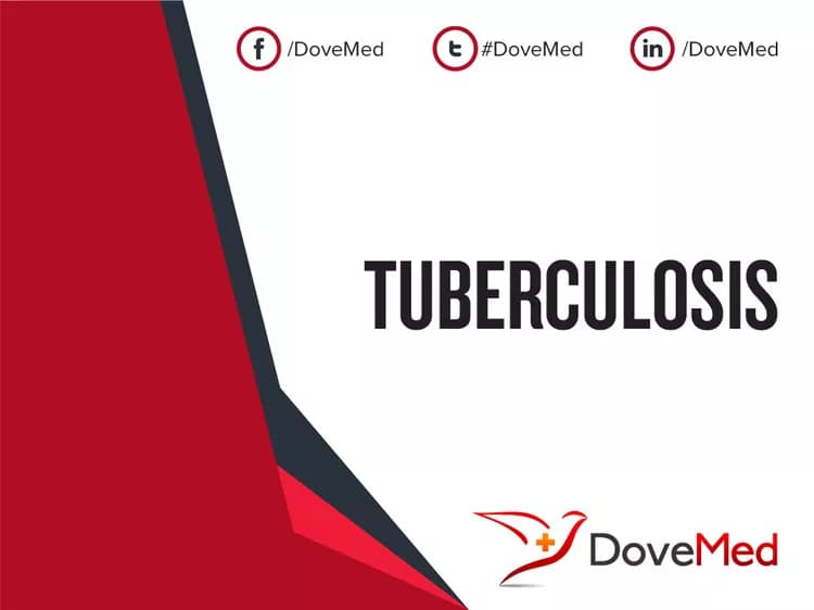 Is the cost to manage Tuberculosis (TB) in your community affordable?