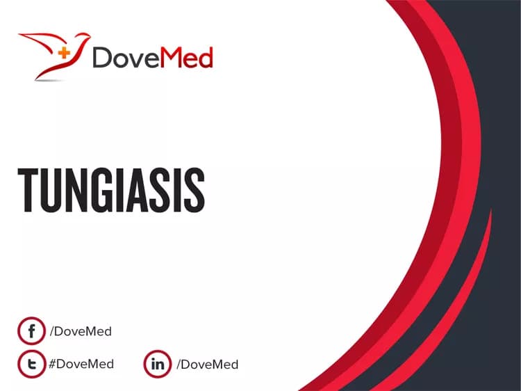 Tungiasis