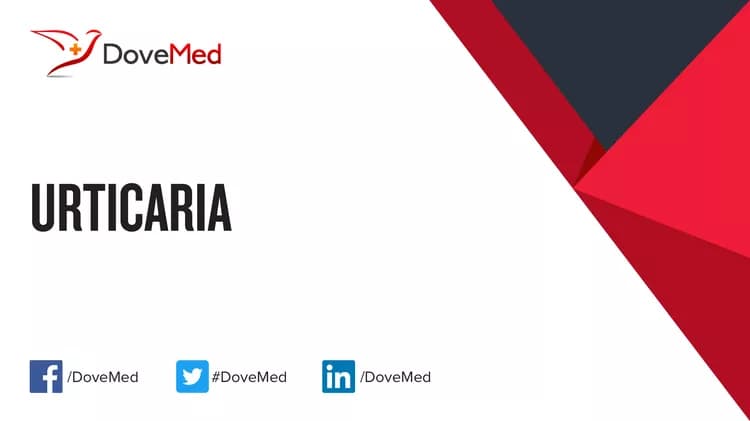 Urticaria