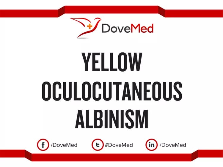 Yellow Oculocutaneous Albinism