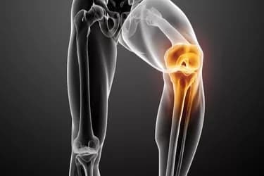 The Facts On Glucosamine