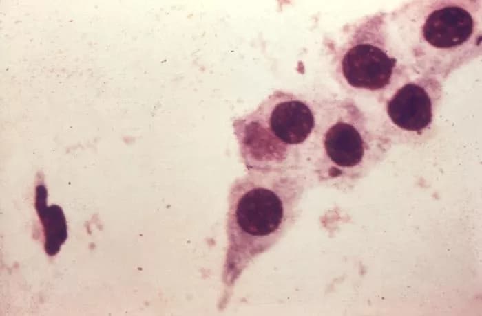 Chlamydia Testing