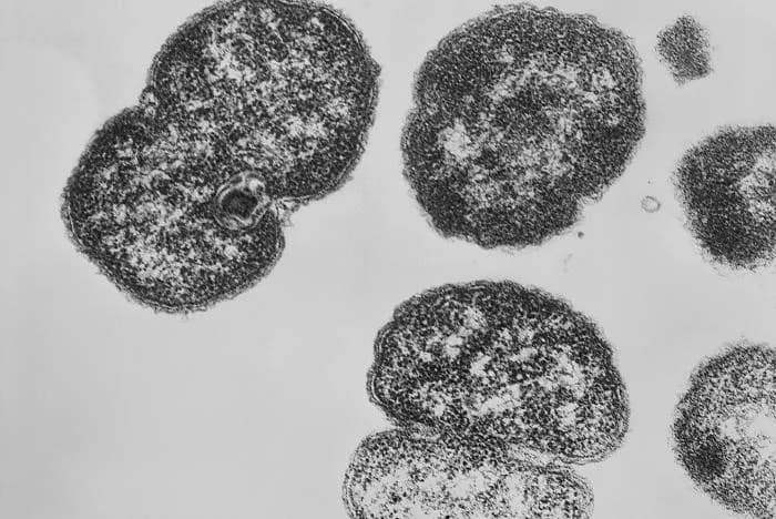 More Than 75 Percent Of STD-negative Patients Receive Antibiotics
