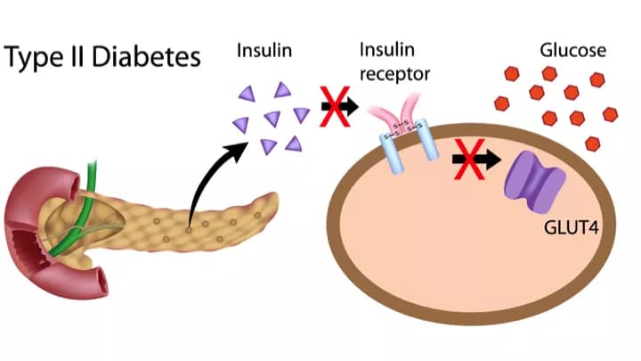 Diabetic Nerve Pain, A Potential Hope for Relief