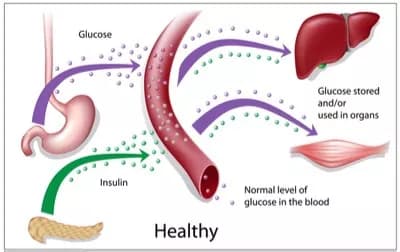Injection Alternative: Model Predicts Performance Of Glucose-Responsive Insulin