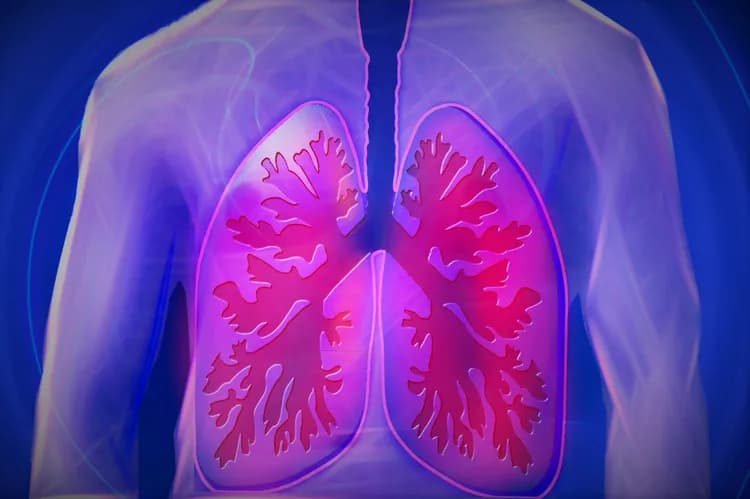 People With COPD Suffer Fewer Lung-Related Problems When Treated With Targeted Lung Denervation