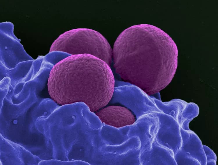 Narrow Wavelength Of UV Light Safely Kills Drug-Resistant Bacteria