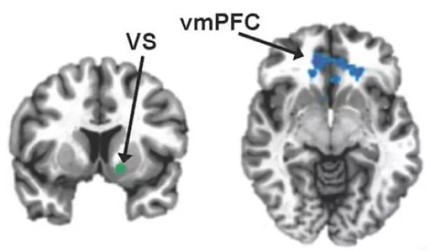 Felger et al, Molecular Psychiatry (2015)