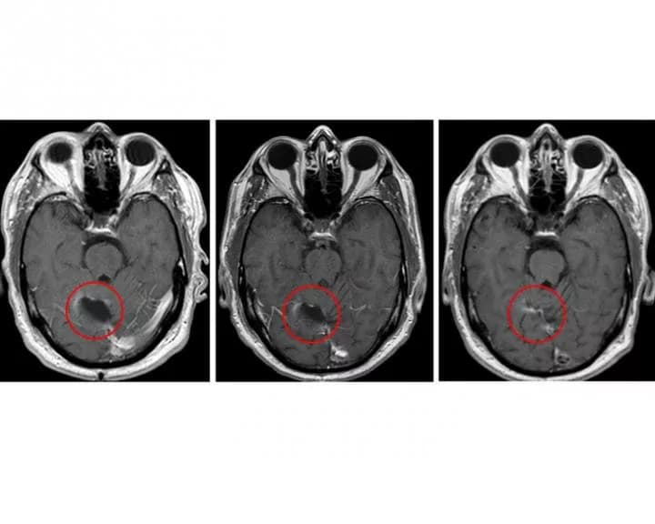 Clinical Cancer Research/American Association for Cancer Research