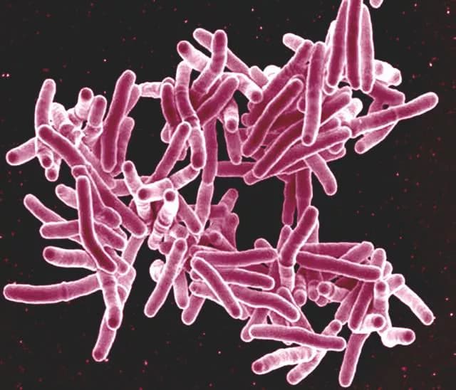 Occurrence of Multidrug-Resistant Tuberculosis On the Rise in India