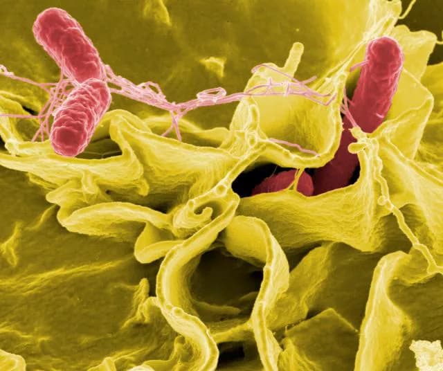 Salmonella Enterocolitis