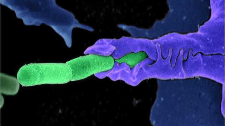 Camenzind G. Robinson, Sarah Guilman and Arthur Friedlander, United States Army Medical Research Institute of Infectious Diseases